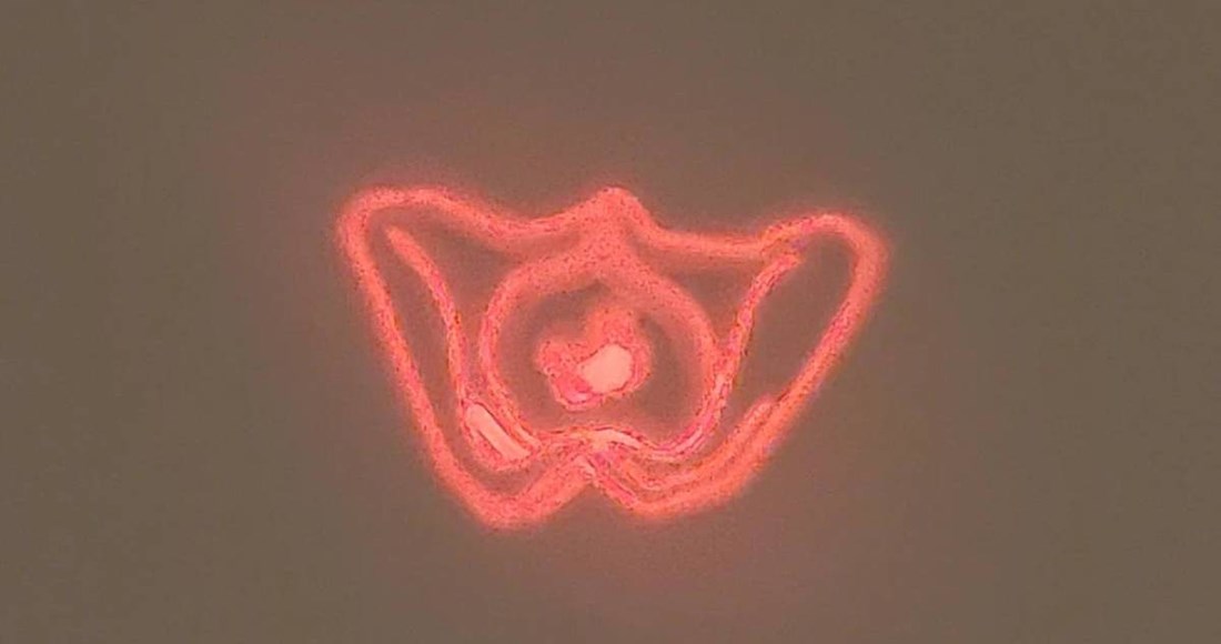 A Mom’s Mystery Toy Projector Had Reddit Guessing All Night