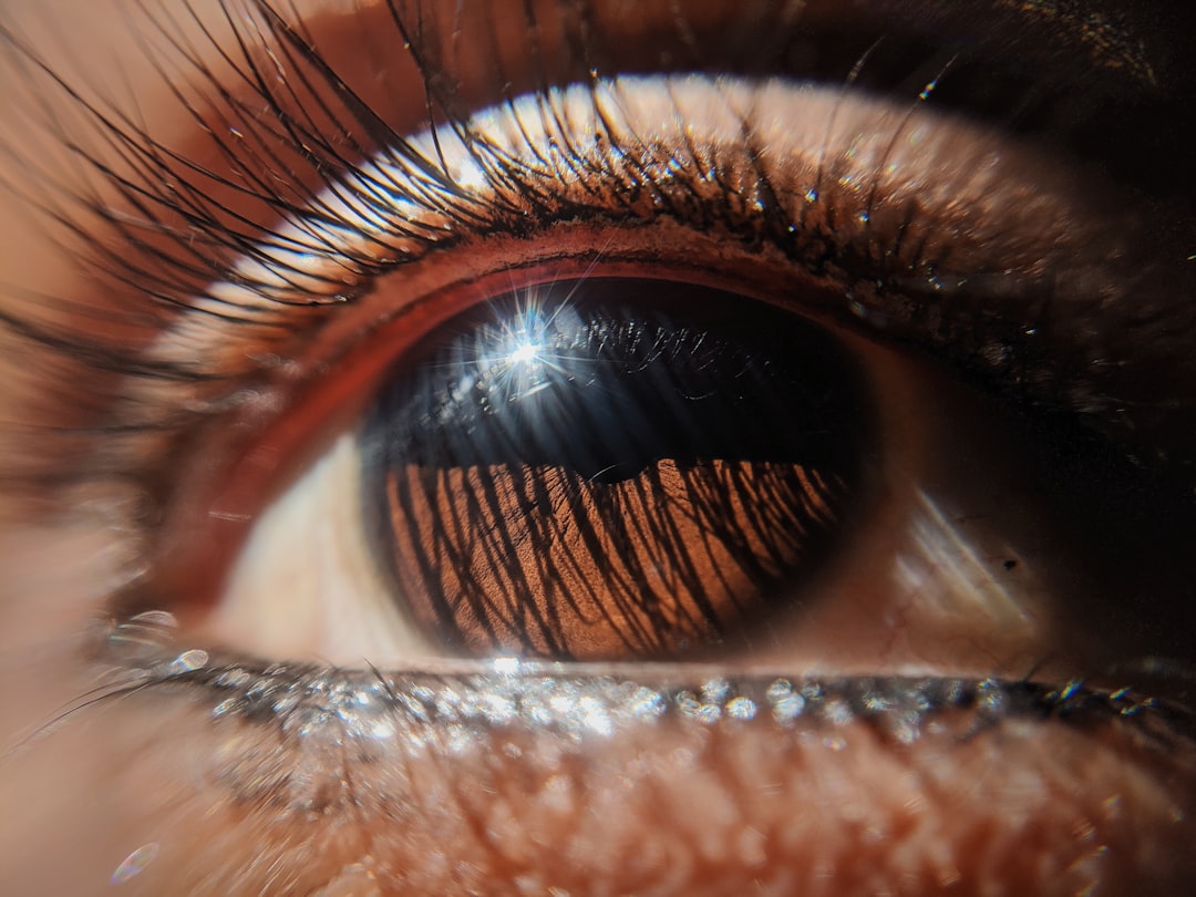 Dry Eyes Close-up With Gritty Texture And Sensitivity To Light