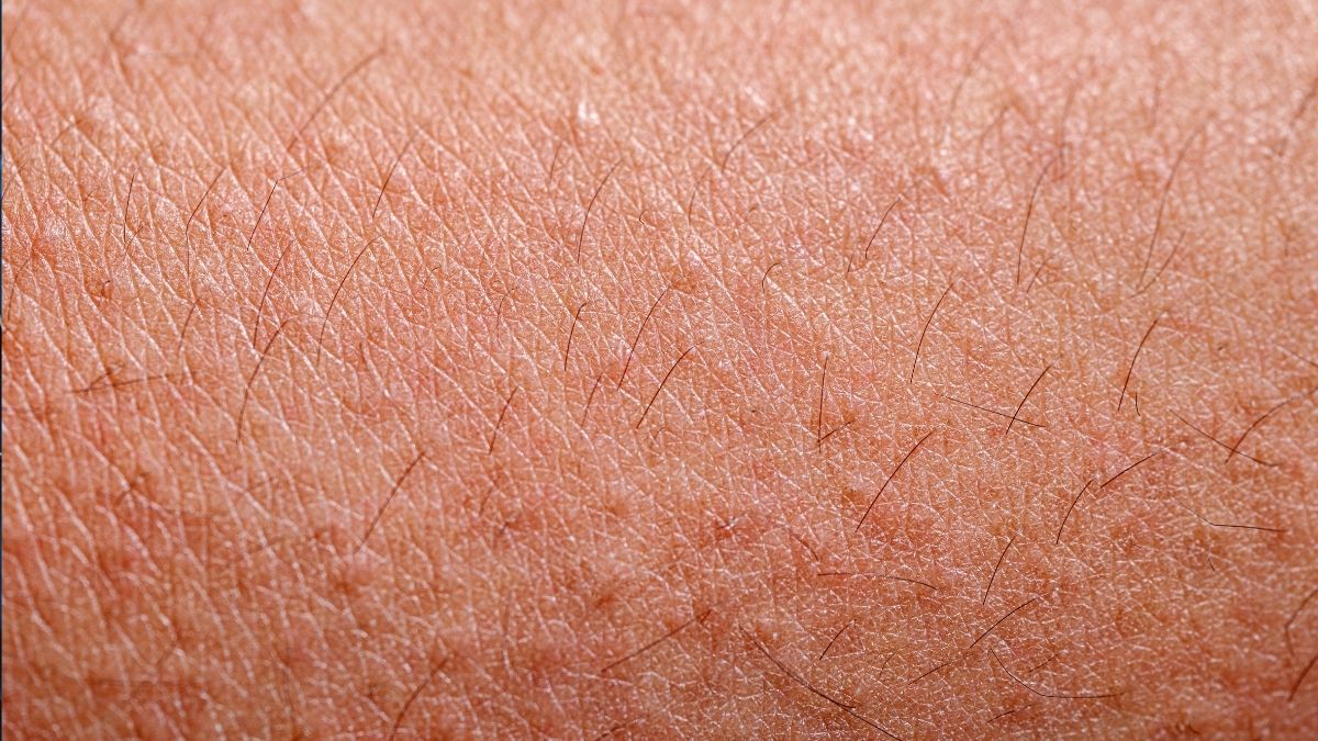 What Those Tiny Red Dots on the Skin Really Are and Whether They Should Concern You