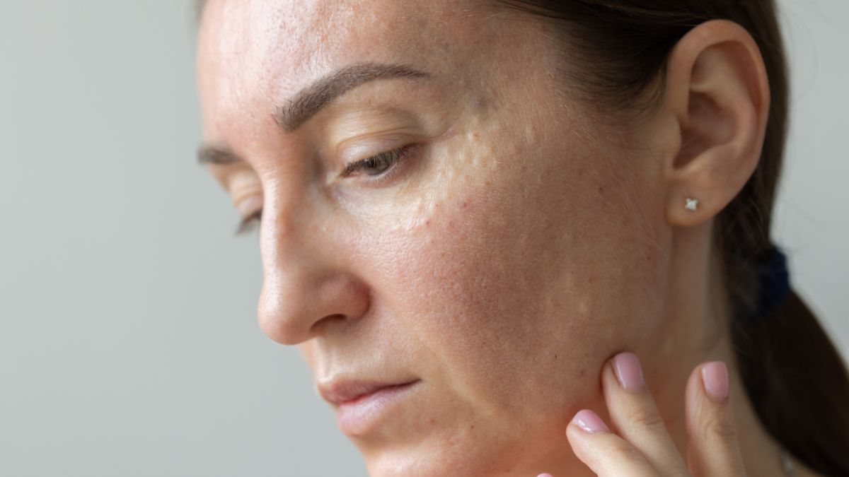 Habits That Are Aging Your Skin Faster Than You Realize