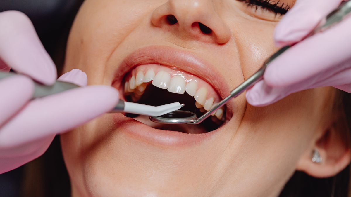 30 Habits That Are Secretly Ruining Your Teeth Enamel