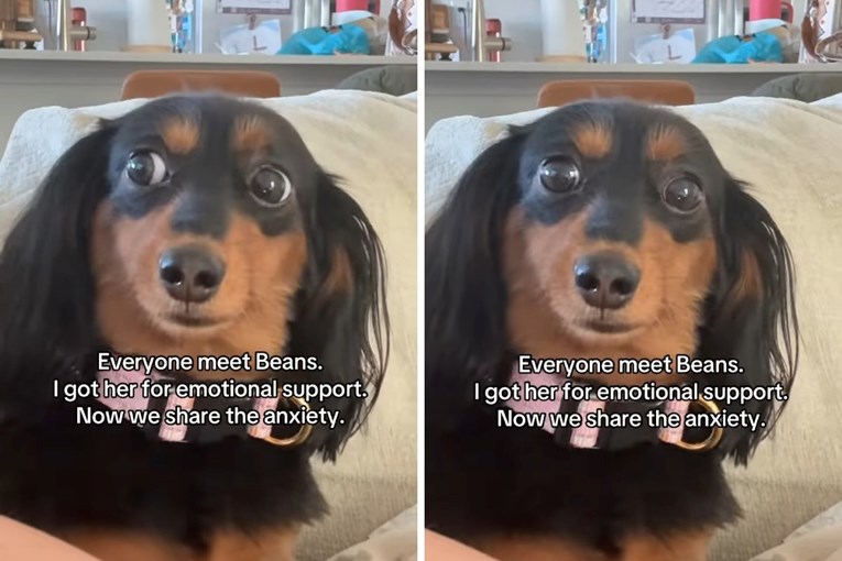 Woman Adopts Dachshund for Emotional Support Only to Find the Dog Is Just as Anxious