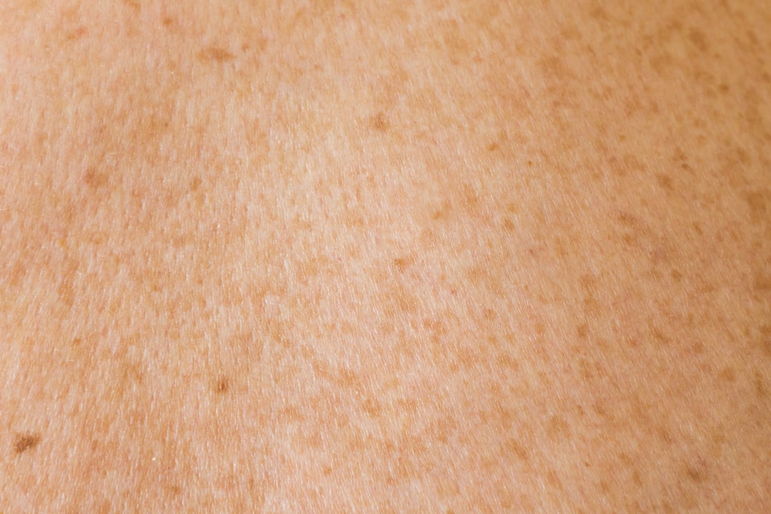 Excessive Tanning Skin Damage Aging