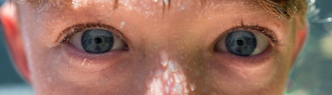 Dry Eyes Dehydration Scratchy Gritty Contact Lenses