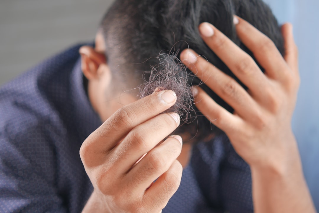 Hair Loss Signs