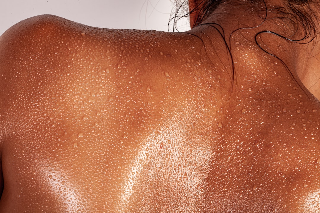 Excessive Sweating Signs
