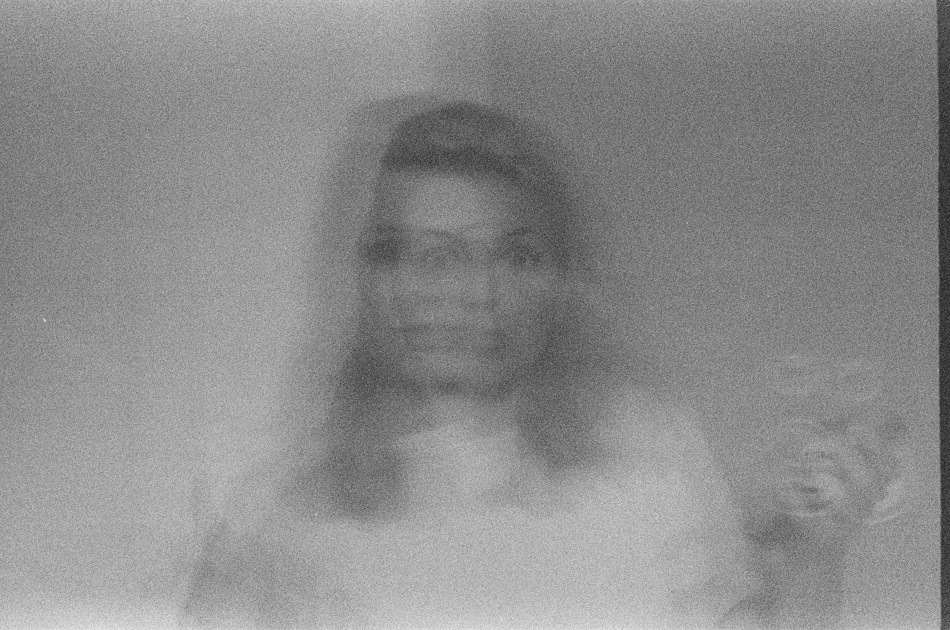 Person With Double Vision