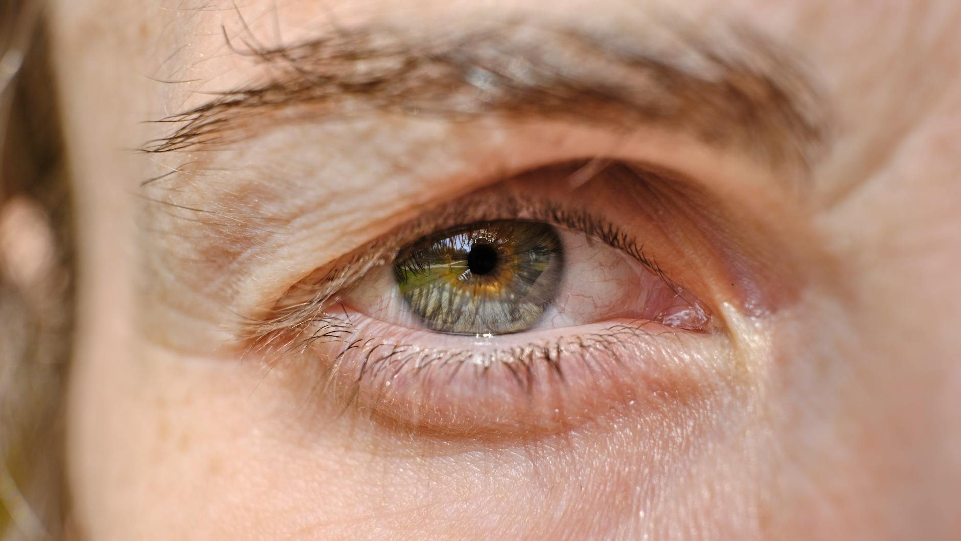 Person  Rapid Blinking