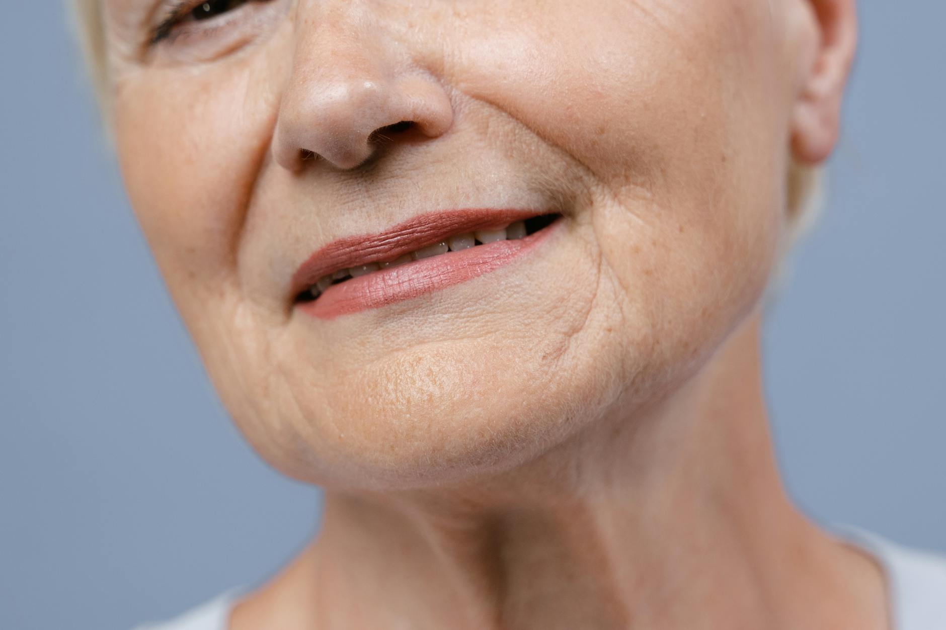 Premature Skin Aging Due To Sugar Glycation