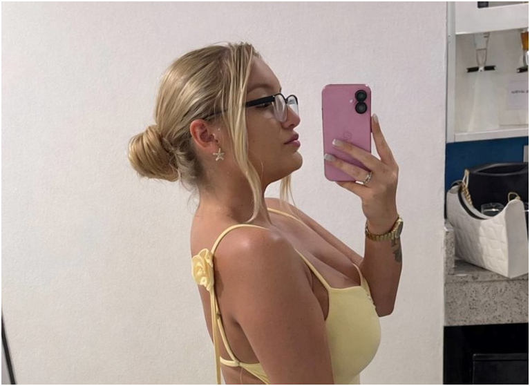 A 23-Year-Old Has Been Allergic to Water for 10 Years and Says People Think She Is Making It Up