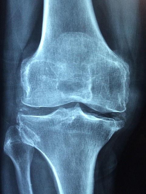Joint Pain Image