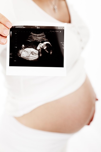 Pregnant Woman Ultrasound