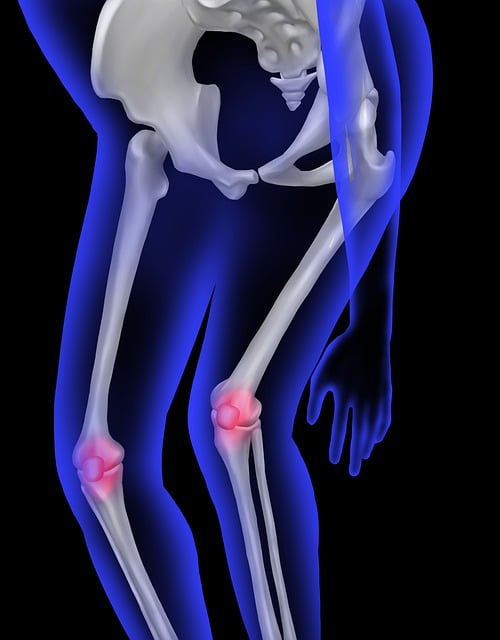 Bone Pain Symptom