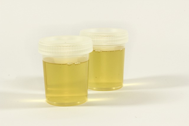 urine