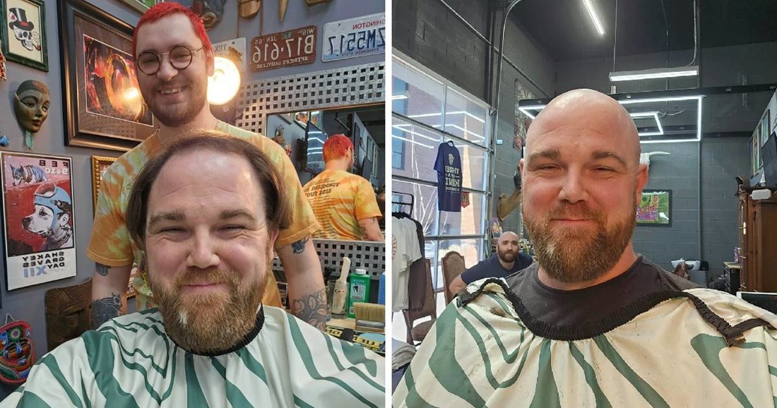 He Shaved His Head Due to Hair Loss and Wowed Everyone: “You Look 30,000 Times Better”