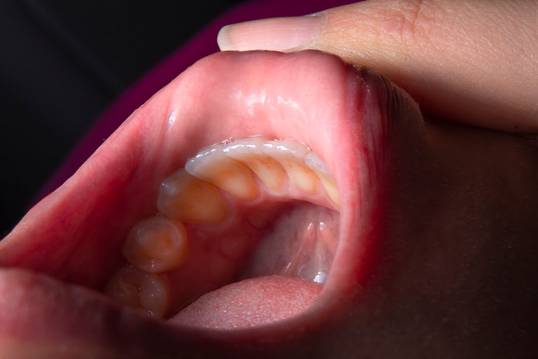 Mouth With Sores