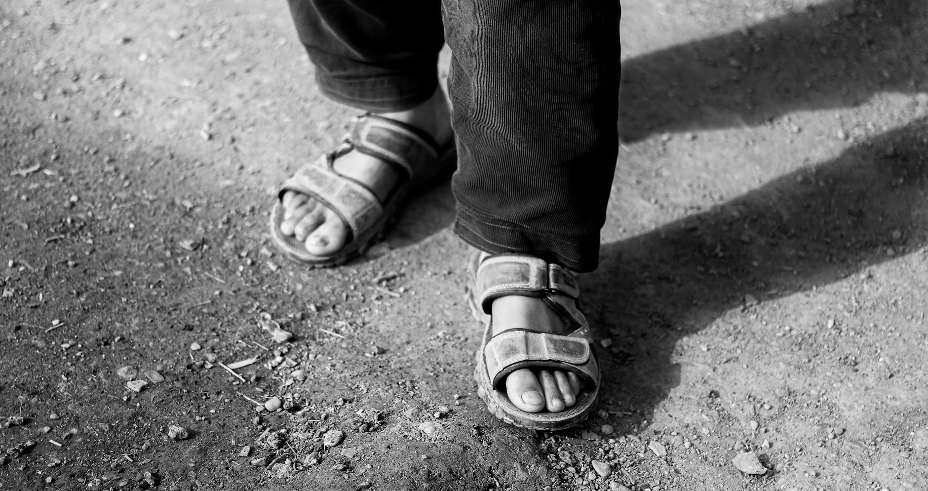 Overly Casual Sandals