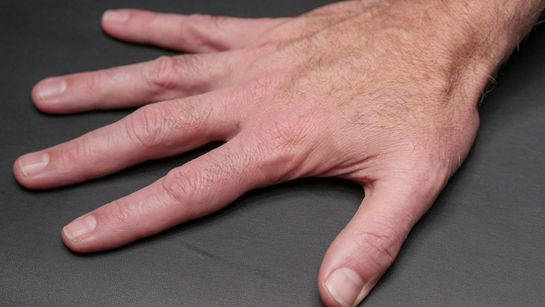 Fingernails Human Body