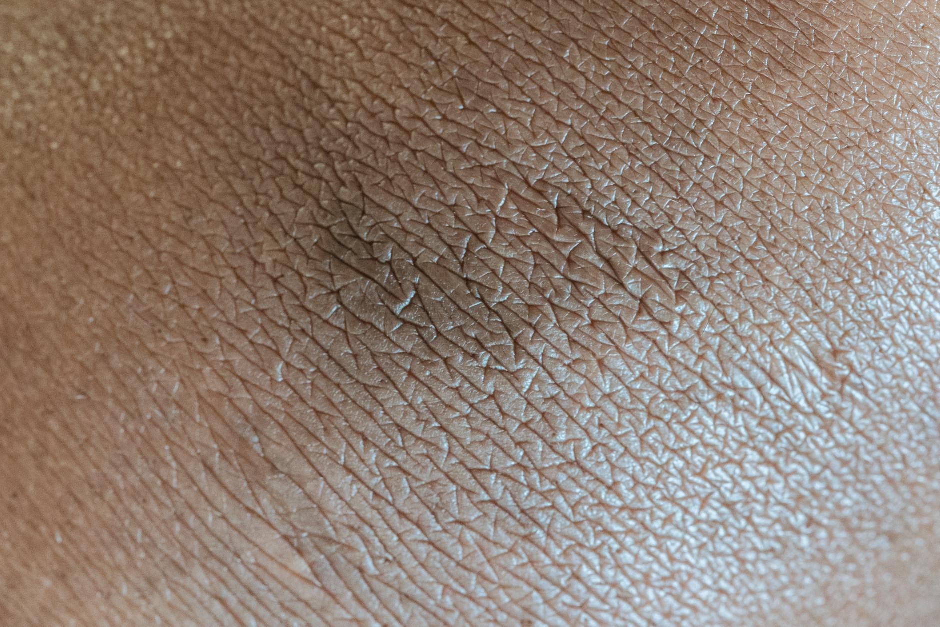 Skin Changes Symptom
