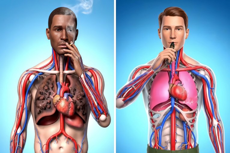 A Viral Simulation Compared Smoking and Vaping: Which Is Worse for the Body?