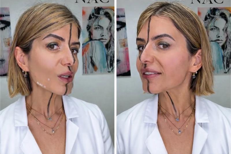 A California Doctor Injected Botox Into Only One Side of Her Face to Show What It Actually Does