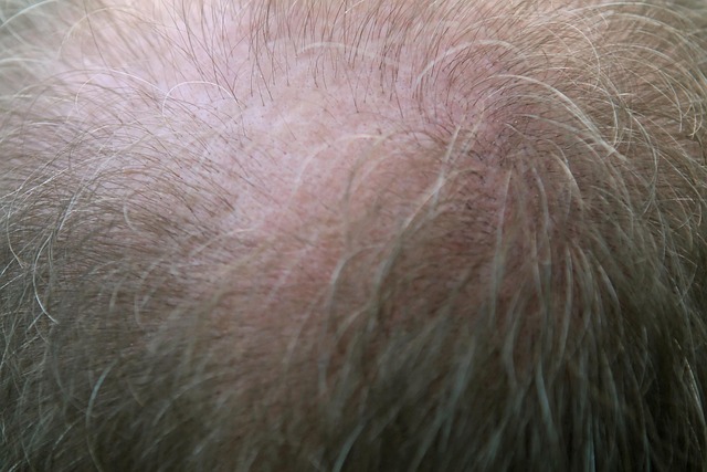 Thinning Hair Close-Up